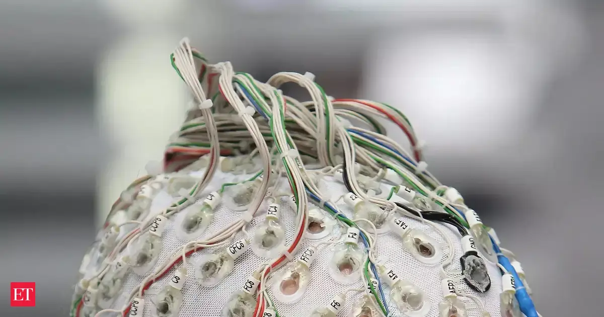 China’s brain-computer interface trial cuts hydrocephalus diagnosis from days to 30 minutes