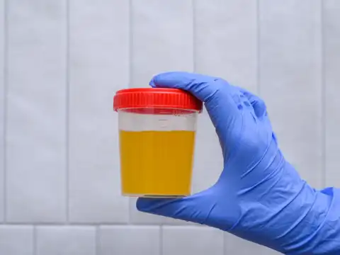 Blood in urine or semen