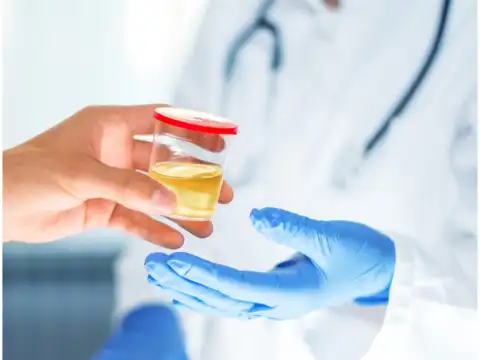  Urinary flow changes