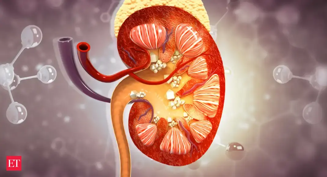 8 foods you should avoid to prevent kidney stones and protect your health