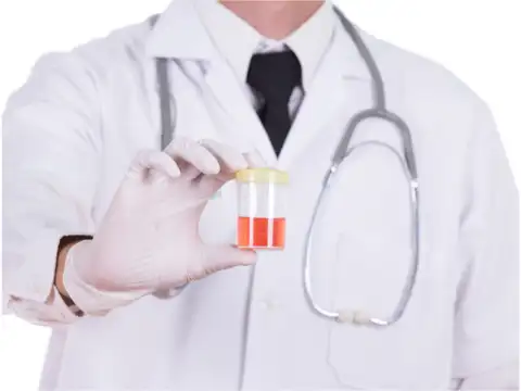 Reddish or pink urine