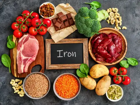 Building an iron-smart plate