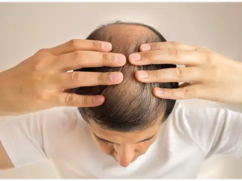 In your 40s: Maintenance becomes the main goal