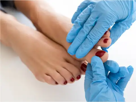 Finger Clubbing