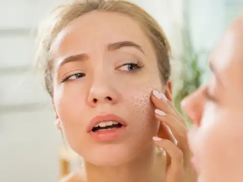 Dry skin and eyes