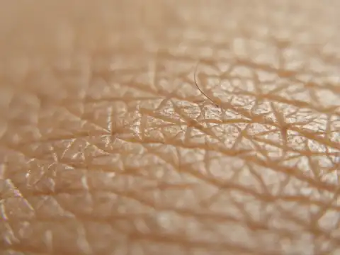 Changes in skin and hair