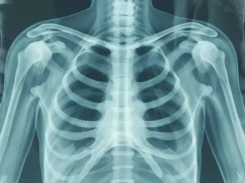 Discomfort below the right rib cage