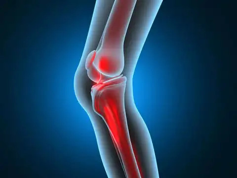  Bone pain or frequent stress fractures