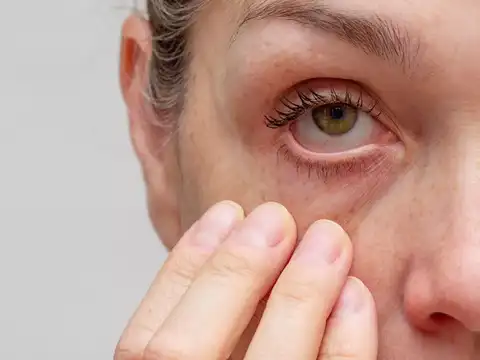 Risk 4: corneal epithelial damage