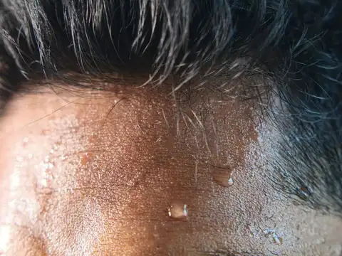  Clammy or very sweaty skin