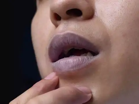  Bluish lips or nails (cyanosis)