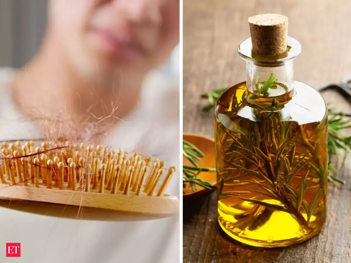 5 home remedies you can start today for your hair loss - Fix hair loss ...