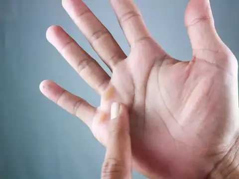Sign 4: swelling, warmth, or tenderness in joints