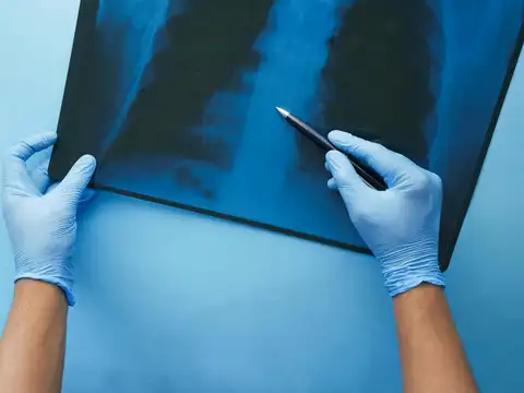 The dangers of over-testing