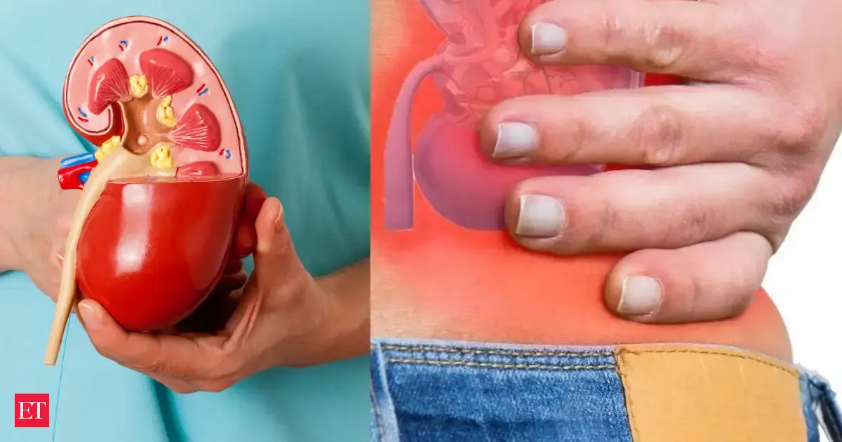 Mumbai doctor warns: Winter can trigger painful kidney stones, 6 crucial things you must do to stay safe