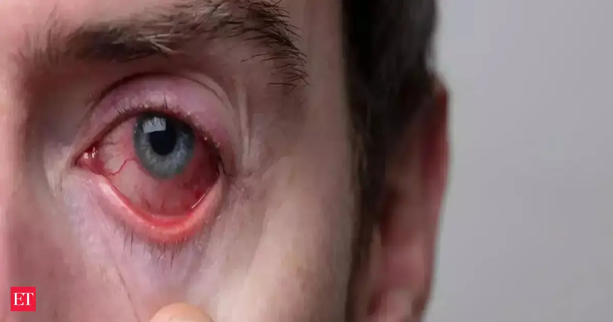 Your eyes hold secrets to how long you live. New alarming study finds link between eyes, heart disease and diabetes. Check details