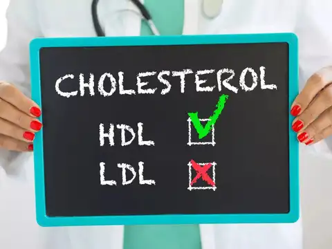 Home lipid panel via lab pickup