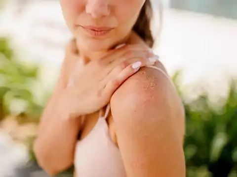 Very dry, flaky skin