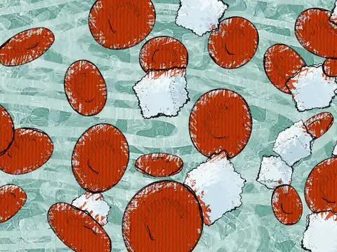  How muscle contraction grabs glucose (without insulin's help)