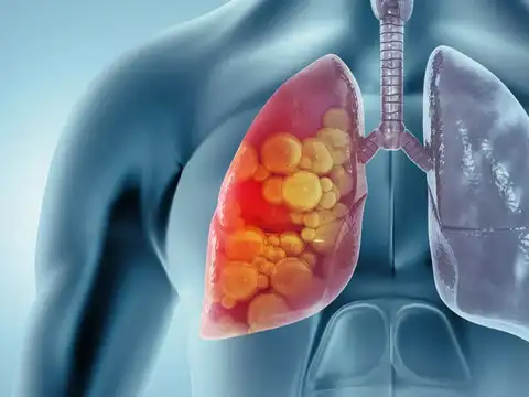 Lung Disease: Broken Gas Exchange