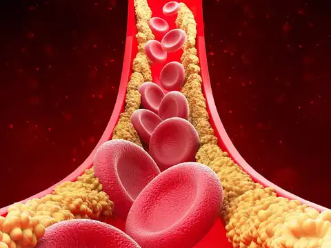 Oxidative stress and chemical imbalance wreak havoc