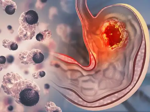  Inflammation blocking cell membranes