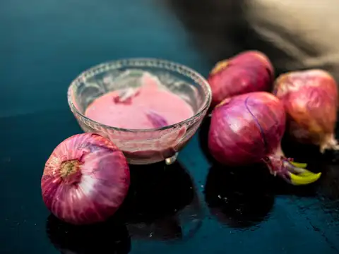 Onion Juice for Hair Regrowth