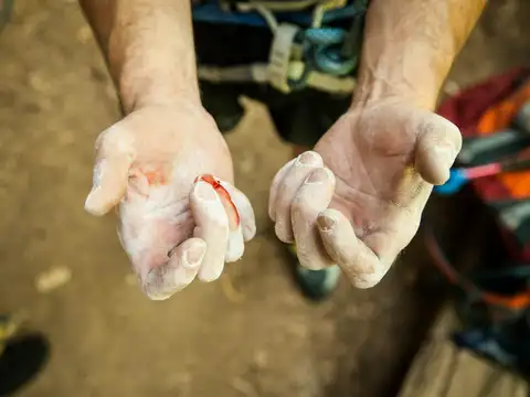  Tiny Bleeding Spots