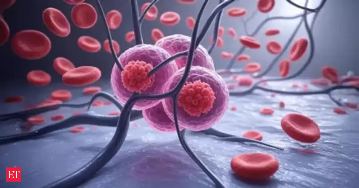 Pancreatic cancer cure: Could this new triple therapy finally conquer pancreatic cancer? Here's what results from lab studies show