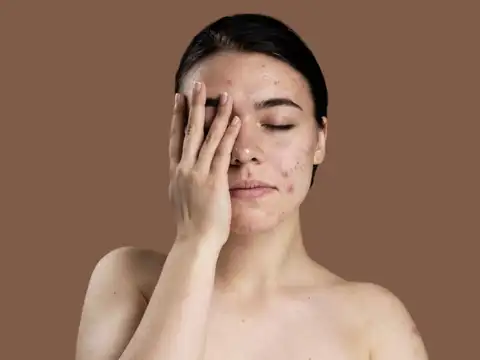 Routine for Mildly Dry Skin