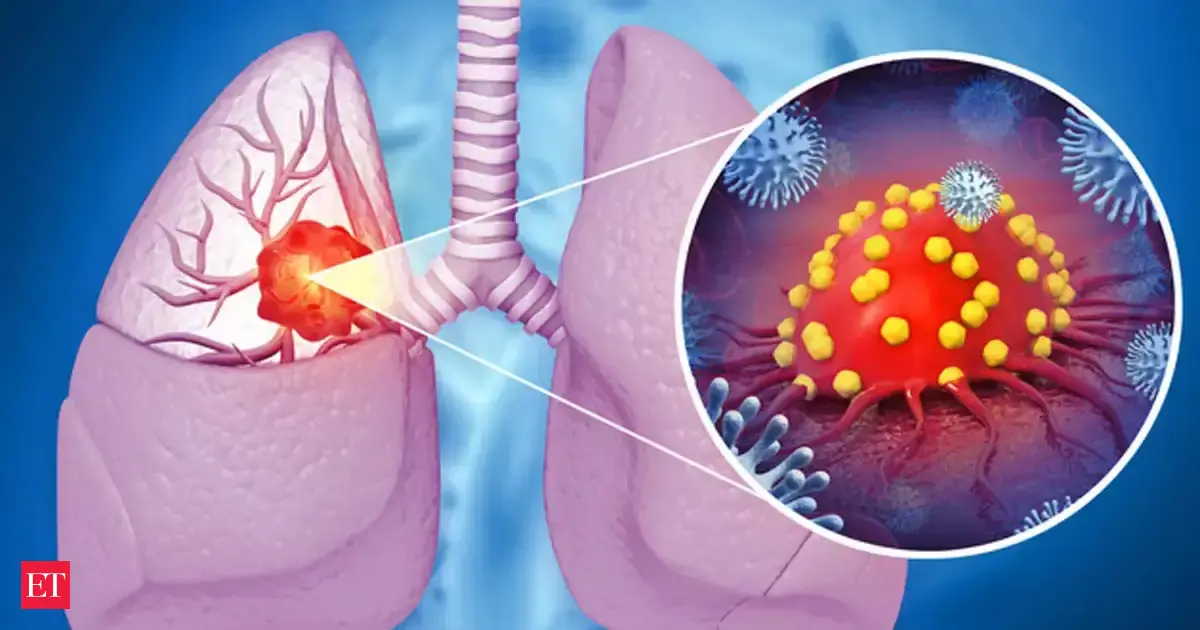 Rising pollution levels in Mumbai contributing significantly to lung cancer: Maharashtra government
