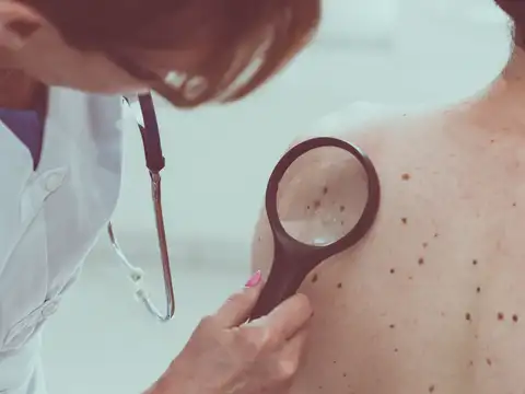 Are moles always harmless