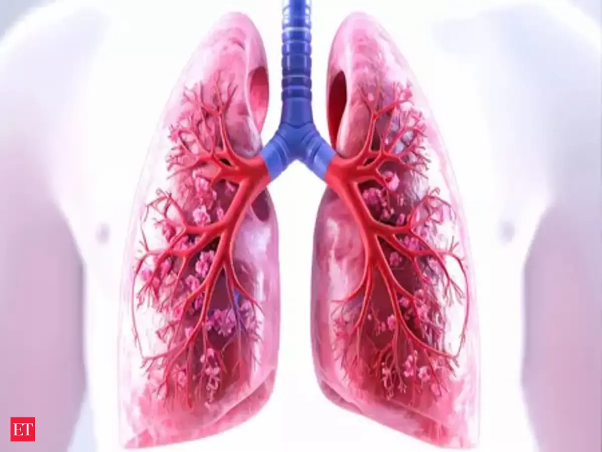 Tuberculosis rates spike in northern Saskatchewan, NDP alleges government withheld case information