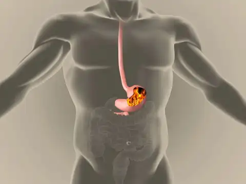 Acidity and "Pet ki Jalan"