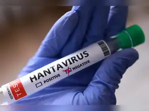 Common misconceptions about hantavirus Common misconceptions about hantavirus