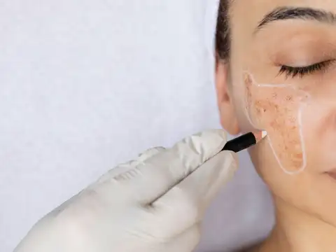 Expert opinion on retinol use