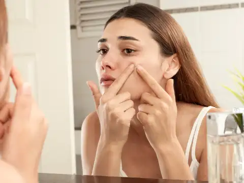Pimples after stopping