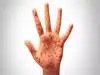 World's most contagious disease detected in California wastewater: Key signs of virus and symptoms you should watch