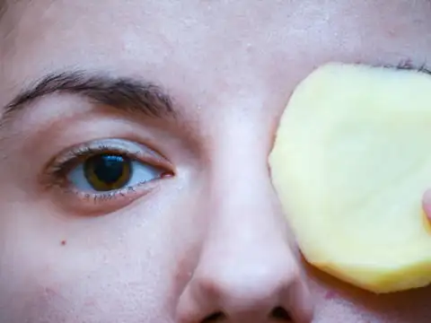 Your next face mask ingredient is free? Potato peels help remove dullness
