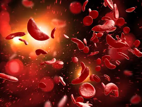 What is Sickle Cell Disease