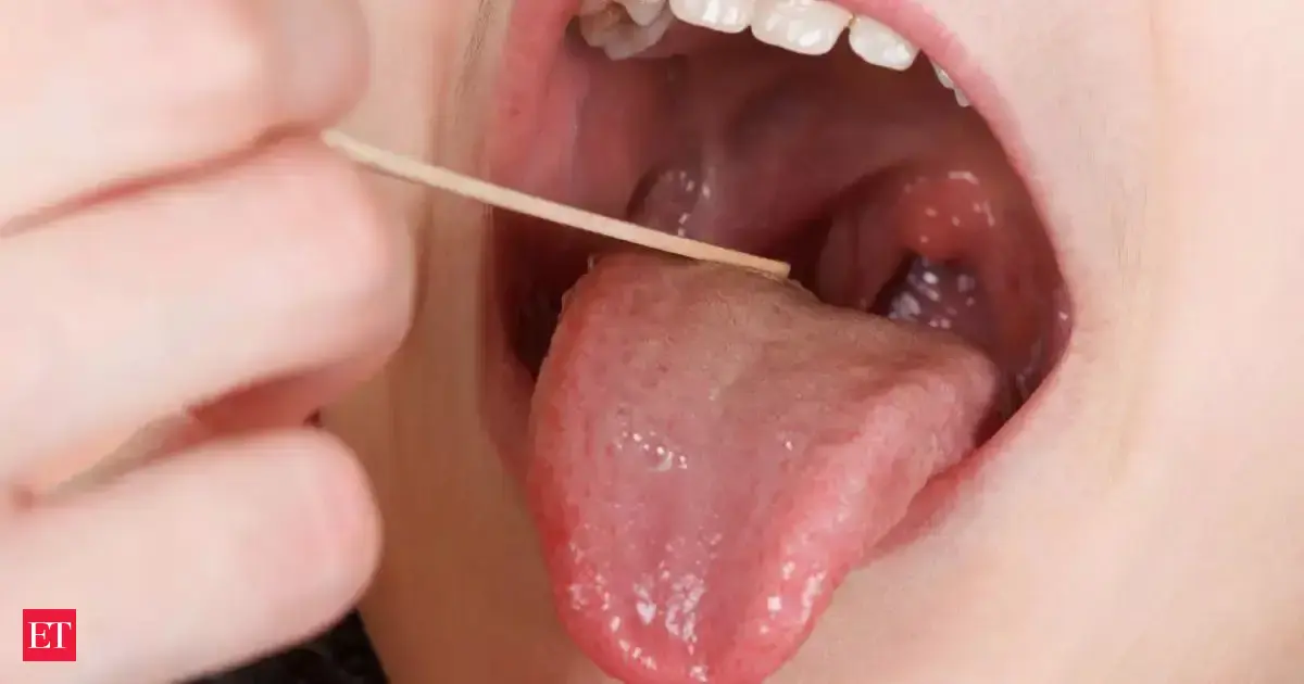 Sore Throat Or Tonsillitis Symptoms Causes Why Infections Keep Coming Back And New Treatment Options Explained