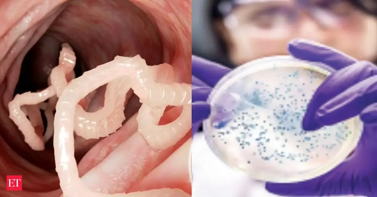 Mysterious parasite outbreak in US sickens 300 people: Check Cyclospora symptoms, treatment and precautions you sould take