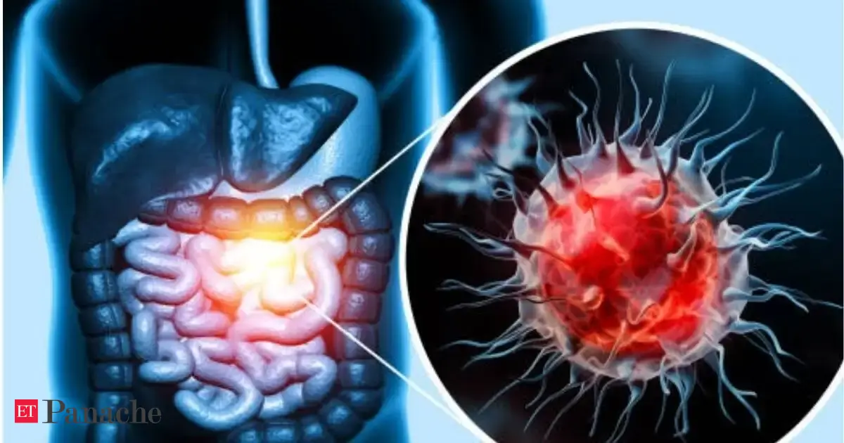 Colon cancer is no longer 'old people's disease. Doctor on X names one popular food as 'biggest risk factor' : 'It is a carcinogen like tobacco'
