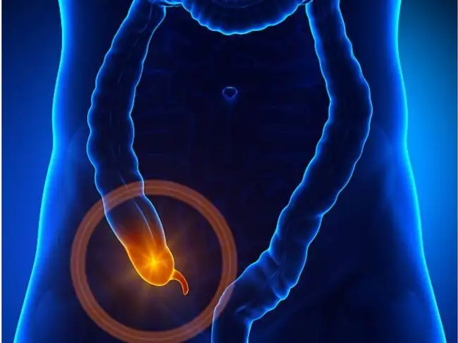 Appendix