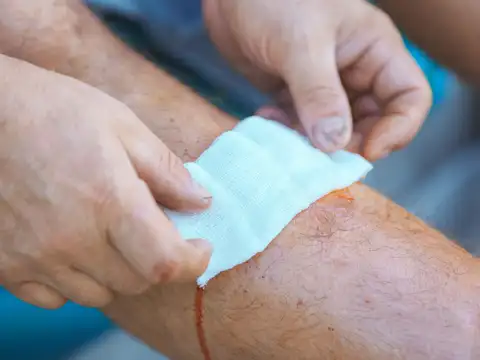 Slow Wound Healing