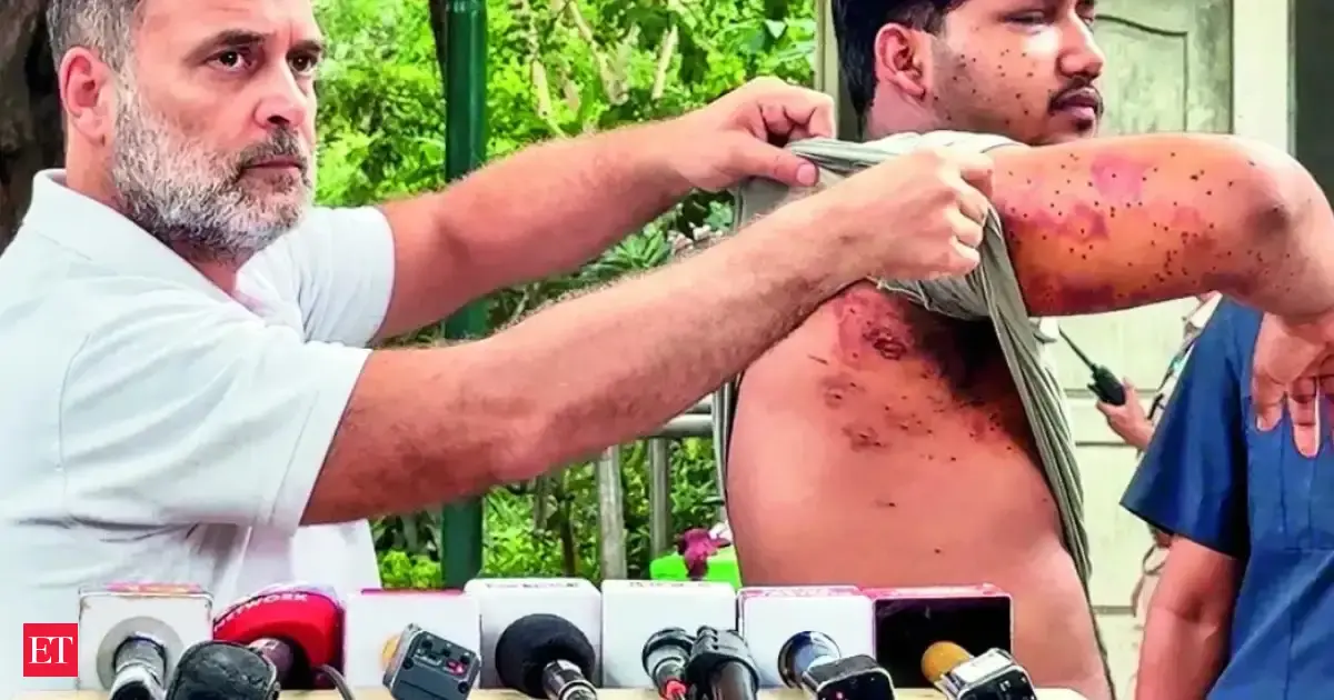 SC directs Delhi govt to treat Jantar Mantar protesters injured in pellet firing