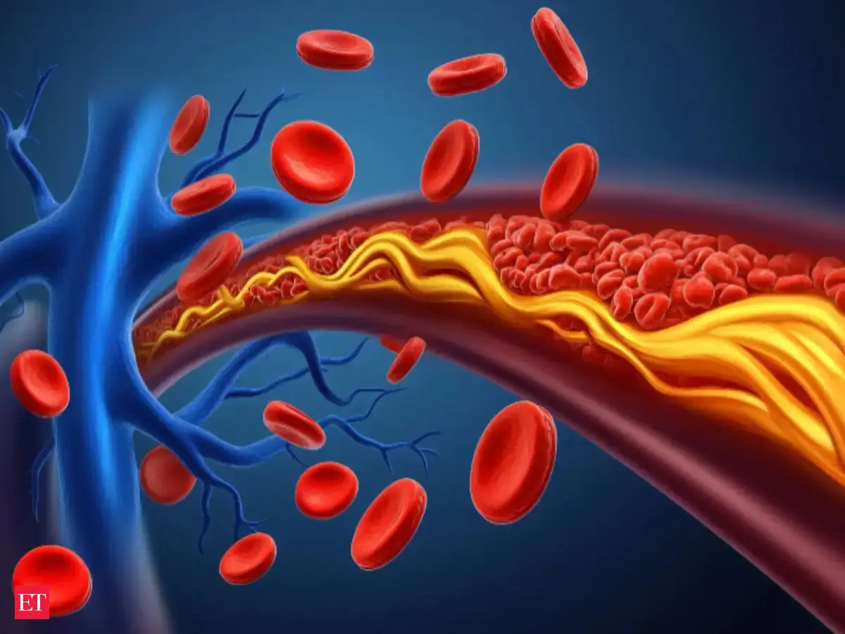 India, China bore one-third of global 'bad' cholesterol burden in 2023: Study