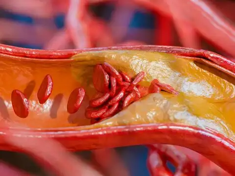 Its Peel Extract May Slow Plaque Progression In Advanced Cases