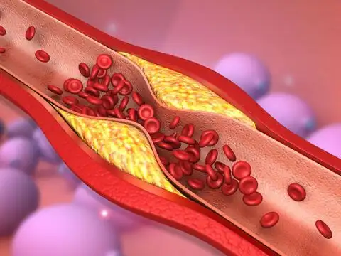 It May Help Lower Blood Pressure, Which Strains Artery Walls