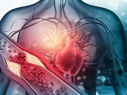 Its Antioxidants Reduce LDL Oxidation, A Key Driver Of Plaque